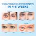 24K Gold Eye Patches for Puffy Eyes - 60 Pcs Under Eye Masks for Dark Circles Wrinkles & Puffiness - Best Treatment for Men & Women - Buy Online on GoSupps.com