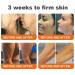 8-In-1 Bee Venom & Tallow Skin Firming &Treatment Cream Bee Venom Skin Treatment Cream Deeply moisturizes firms and repairs skin blemishes(2PCS) - Buy Online on GoSupps.com
