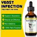 Yeast Infection Treatment for Dogs Natural Ear Infection Treatment Dog Allergy Relief Supports Itchy Skin Relief Skin and Coat Support Inflammation Relief for Dog Herbal Supplement - 2 oz - Buy Online on GoSupps.com
