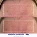 Wrinkles Schminkles Facial Smoothing Set | Mouth Lip & Eye Patches | Forehead Reusable Silicone Pads | International Shipping Available - Buy Online on GoSupps.com