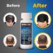 Kirkland Minoxidil 5% for Men - 6 Months Hair Regrowth Supply (12 Oz) - Shop Internationally - Buy Online on GoSupps.com