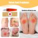 24PCS Corn Remover Pads with Hole - Pain Relief Corn Plasters for Feet & Hands - Buy Online on GoSupps.com