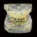 Dental Orthodontic Demonstration Model - Arch Wire Metal Bracket for Teaching & Study (Clear) | International Shipping - Buy Online on GoSupps.com