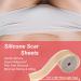 Silicone Scar Sheets 1.6 x120 - Medical Grade Reusable Scar Tape for Keloid C-Section Surgery Burn & Acne Treatment - Buy Online on GoSupps.com