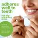 AquaSonic Professional Teeth Whitening Strips - Enamel Safe & Effective Spearmint - Easy to Use Non-Slip Affordable International Shipping - Buy Online on GoSupps.com