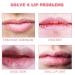2022 Lip Scrub Exfoliator & Moisturizer Kit - Dark Lips Exfoliator & Moisturizer (1pcs) - Buy Online on GoSupps.com