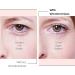 Small Wonderstripes Eye Lid Tape - 64 Pack | Eyelid Lifting Strips for Hooded & Droopy Eyes | Invisible Silicone Tape for All Shapes | Easy Makeup Application - Buy Online on GoSupps.com