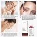AHA 30% + BHA 2% Peeling Solution for Face - Exfoliating Chemical Peel at Home - Fine Line & Wrinkle Treatment - 1 fl oz - Buy Online on GoSupps.com