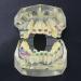 Dental Orthodontic Demonstration Model - Arch Wire Metal Bracket for Teaching & Study (Clear) | International Shipping - Buy Online on GoSupps.com