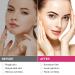Ellocy Face Wrinkle Patches - 192PCs Forehead & Facial Tape for Anti-Wrinkles - Buy Online on GoSupps.com