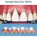 Whitening Gel Pen Teeth Whitening Pen Easy and Effective Teeth Whitening Teeth Whitening Pen Whiten Teeth Easily Teeth Care Whitening (5) - Buy Online on GoSupps.com