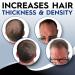 Natural Hair Growth Foam - Biotin & Keratin Formula for Men & Women | Promotes Regrowth & Strength - Pack of 3 (1.22 oz - Buy Online on GoSupps.com
