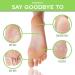 Hicream Foot Peel Mask- Exfoliating Foot Mask for Cracked Heels & Dead Skin - Removes Calluses & Repairs Rough Heels - 2 Pairs, Original Scent - 2 Count - Buy Online on GoSupps.com