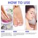 Ingrown Toenail Treatment - Painless Corrector Strips & Nail Correction Patches | 100 Pcs - Buy Online on GoSupps.com
