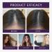 S rum de croissance capillaire l'oignon et au romarin s rum pour le cuir chevelu spray de croissance capillaire pour femmes la formule l g re s rums nourrissants pour le cuir chevelu. (6PCS) - Buy Online on GoSupps.com