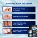 Extra Strength Toenail Fungus Treatment 30ML - Fast Relief for Men & Women | Nail Fungus Cure - Buy Online on GoSupps.com