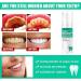 Lenaro Probiotics Teeth Whitening Mousse - 2PCs Herbal Oral Repair for Bright Smiles & Fresh Breath - Buy Online on GoSupps.com