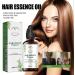 Shelure Hair Growth Oil Shelure Hair Regrowth Oil Shelure Hair Regrowth Treatment Oil Natural Hair Growth Oil Hair Regrowth Extract Oil Hair Growth Oil for Women (1) - Buy Online on GoSupps.com