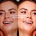 ASHUDAN Dark Spot Remover Cream for Face | Sun Spot, Melasma, Age Spot Correction | Hyperpigmentation Treatment for Women and Men - 1.7 Fl Oz - Buy Online on GoSupps.com