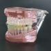 HDGRNCC Dental Orthodontic Brackets Model - Metal Ceramic Self-Ceramic Bracket for Training | International Shipping - Buy Online on GoSupps.com
