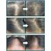 WHITESILK (100ml) THE SCM 85 (human stem cell) + HGF Therapy Anti-Hair Loss Hair Scalp EXPERT Serum Promotes Growth and Lessens Hair Loss with SCM-3D Biomimetic Technology - Buy Online on GoSupps.com