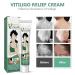 Vitiligo Care Cream - Natural Treatment for Skin Pigmentation | Reduce White Spots, Improve Skin Tone - Buy Online on GoSupps.com