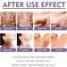 Whitening Skin Balm Armpit Knees Elbows Whitening Skin Stick Dark Spot Corrector Cream Body Moisturizing Brightening Stick Dark Elbows and Knees Lightening Natural Underarm Lightening Cream - Buy Online on GoSupps.com