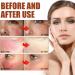 Rosacea Face Serum Face Serum Hyaluronic Acid Face Oil Anti-Aging Relieve Redness &Quick Repair Damage Skin Niacinamide Serum Replumps & Hydrates Collagen Face Serum-Protect Skin+Reduce Acne-Women 1 - Buy Online on GoSupps.com