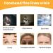 Forehead Wrinkle Patches - Anti-Wrinkle Pads for Skin Lifting Firming & Moisturizing | Remove Fine Lines & Tighten Skin - Buy Online on GoSupps.com