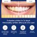 Teeth Whitening Strips - 20 Pap Sessions - Non-Sensitive & Enamel Safe - Made in UK - Mint Flavor - SMILE NOW - Buy Online on GoSupps.com