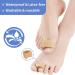 Pack of 8 Gel Toe Separators - Toe Spacers for Overlapping Toes, Crooked Toe Correction, Bunions, Hallux Valgus - Beige - Buy Online on GoSupps.com