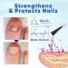 Onyxoguard Nail Growth And Repair Serum Onyxoguard Onyxoguard Serum OnyxoGuard Nail Serum Onyxoguard Nail Cuticle Care Oil Nail Strengthener For Damaged Nails (3 Pcs) - Buy Online on GoSupps.com