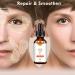 Vitamin C Serum for Face Skincare Serum 20% Vitamin C with Hyaluronic Acid Vitamin E Moisturiser Face Women Skin Care Anti Aging Brightening Wrinkle Facial Serum(30 ml) (Vitamin C) - Buy Online on GoSupps.com