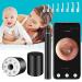 FOJOC Wireless Otoscope Ear Wax Remover ,3.9mm Visual Ear Camera Portable Ear Pick Ear Cleaning Endoscope Kit 1080P HD WiFi Ear Endoscope with LED Light,Waterproof Otoscope for Adults Kids & Pet Black Earwax Remover