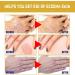 Professional Psoriasis Treatment Cream with New Zealand Bee Venom - Soothing & Moisturizing Formula - 5PCS - Buy Online on GoSupps.com
