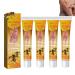 ROKOBN Bee Venom Psoriasis Treatment Cream New Zealand Bee Venom Professional Psoriasis Treatment Cream Soothing and Moisturizing Psoriasis Cream Psoriasis Treatment for Skin (4PCS)