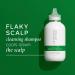 PHILIP KINGSLEY Flaky Scalp Shampoo - Cleansing Scalp Care for Dry, Oily Scalps - Soothes and Calms - 8.45 Fl Oz - Buy Online on GoSupps.com