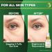 Organic Silk Peptides Eye Cream for Dark Circles & Puffiness - Triple Power Formula for Brighter Eyes | Secret Beauty Club - Buy Online on GoSupps.com