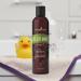 Buy Young Living Cel-Lite Magic Massage Oil 8 oz | Premium Essential Oil for Relaxation Healthy Skin & Hair | Moisturizing Aromatherapy Skincare - Buy Online on GoSupps.com