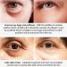 Syansju Lumilight Vshell Eye Cream (3-Pack) - Brighten and Revitalize Your Eyes - Buy Online on GoSupps.com
