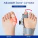 Zeetan Adjustable 2-Piece Toe Corrector - Relief for Bunions & Orthopedic Toe Smoothing with Heel Straps | International Shipping Available - Buy Online on GoSupps.com