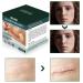 IKKAB Silicone Scar Sheets - Reusable Effective Scar Removal Tape for Surgical Scars, Keloids, C-Section, Tummy Tuck - 1.6 x 60 Roll - Buy Online on GoSupps.com