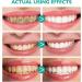 Teeth Whitening Toothpaste Whitening Foaming Toothpaste Strong Stain Removal Toothpaste Cleans Stains Protects Enamel Ultra Active Foaming Toothpaste - Buy Online on GoSupps.com