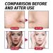 AHA BHA PHA 32% Liquid Exfoliant for Face High-Strength Multi-Acid Peel to Help Refine Skin Texture Enhance Radiance and Support a Smoother-Looking Complexion Suitable for All Skin Types 1 fl oz - Buy Online on GoSupps.com