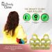 The Beauty Clinic Velcro Rollers for Hair - 10 PCS Self Grip Hair Roller 44mm by 63mm with 6 Duckbill Sectioning Clips Hairdressing Curlers And Self Holding DIY Roller Storage Bag Yellow - Buy Online on GoSupps.com