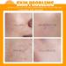 Buy Vitamin C Facial Moisturizer - Anti-Aging Face Cream with Hyaluronic Acid & Centella Asiatica | Best for Dry Skin - Unisex Moisturizer - Buy Online on GoSupps.com