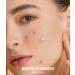 Buy Pimple Patches for Face - Hydrocolloid Acne Strips with Salicylic Acid & Tea Tree Oil - Effective Blemish & Pore Cleansing for All Skin Types - Buy Online on GoSupps.com