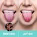 Buy Wmool Steel Tongue Cleaner - Stainless Metal Toothbrush for Oral Hygiene | Adult Tongue Scraper & Brush - Buy Online on GoSupps.com