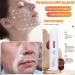 Lingzhii Anti-Wrinkle Rejuvenating Water Ganoderma Serum Face Essence for Hydration Women Anti-aging Firming Skin Moisturizing Improve Dull for All Skin Types (1) - Buy Online on GoSupps.com