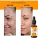 Relaxcation Pure Carrot Seed Essential Oil - Steam Distilled & Unrefined Natural Oil from India | Woody Aromatic Plant Extract for Radiant Skin Smooth Texture & Daily Blends (0.5 oz) 0.5 Fl Oz (Pack of 1) - Buy Online on GoSupps.com